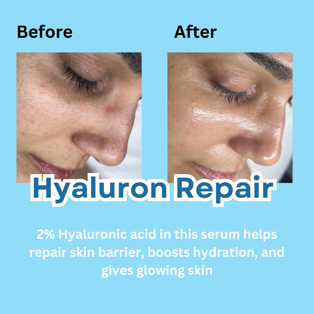 Glow Booster Makeup Prep Kit Rose & Hyaluronic Infused - M&U Skin and Beauty