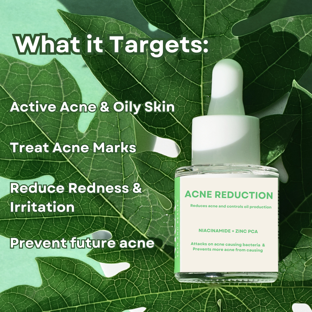 Acne Reduction Combo for Oily Skin (Pack of 4) - M&U Skin and Beauty
