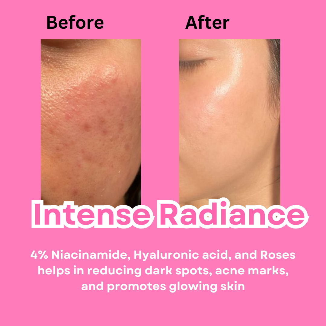 Intense Radiance Glowing Skin Serum - M&U Skin and Beauty