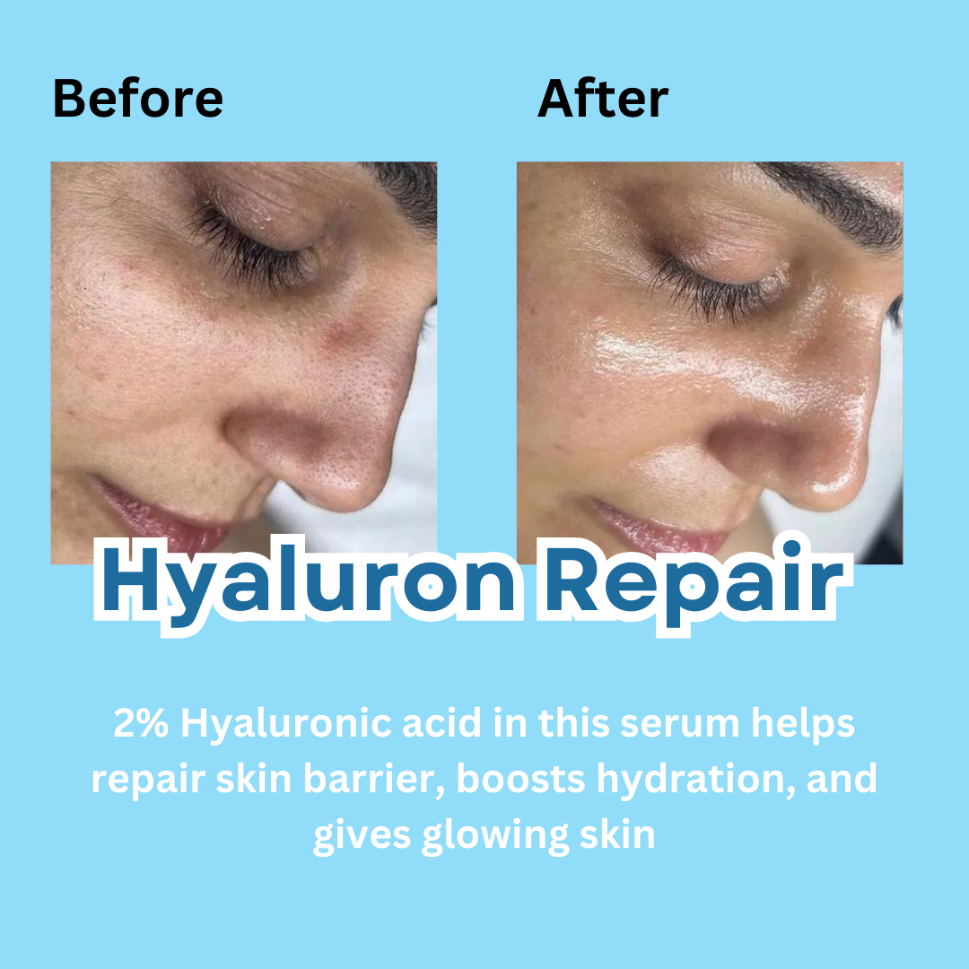 Hyaluron Repair Skin Healing Face Serum